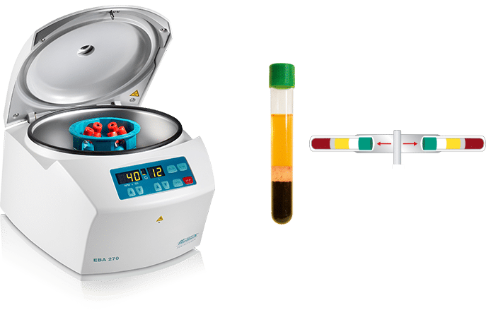 product 3C - Hettich EBA 270 Small Centrifuge