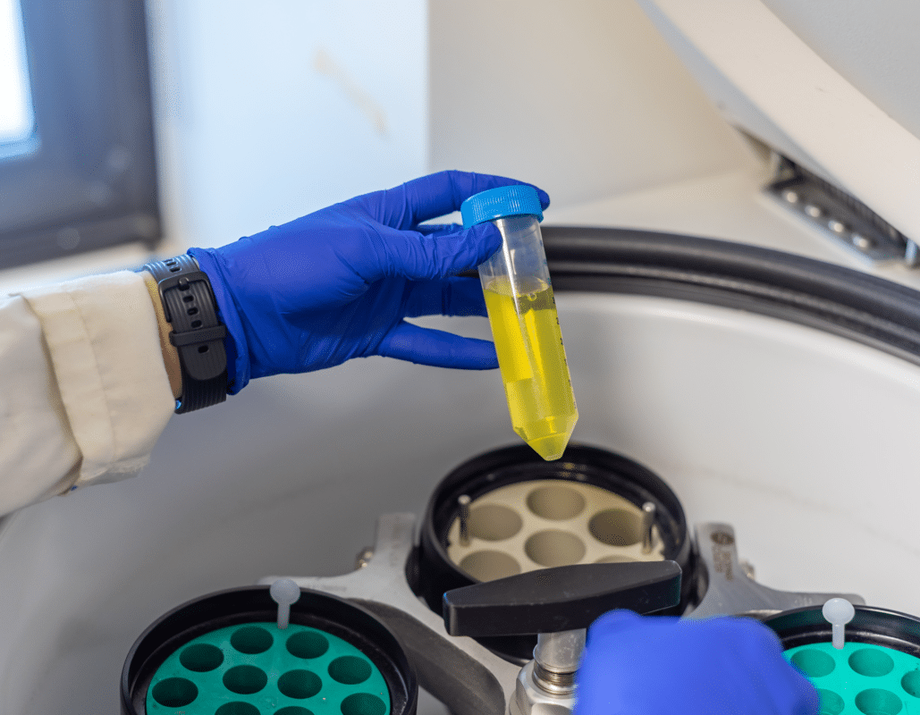 Untitled design 2024 07 11T075710.712 1029x800 - Why High-Speed? Why High-Capacity? Why Ultra? Answering Your Centrifuge Queries